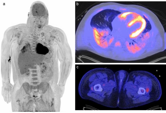 https://cdn.ncbi.nlm.nih.gov/pmc/blobs/6907/10008145/e06e88668a6a/40336_2023_550_Fig3_HTML.jpg