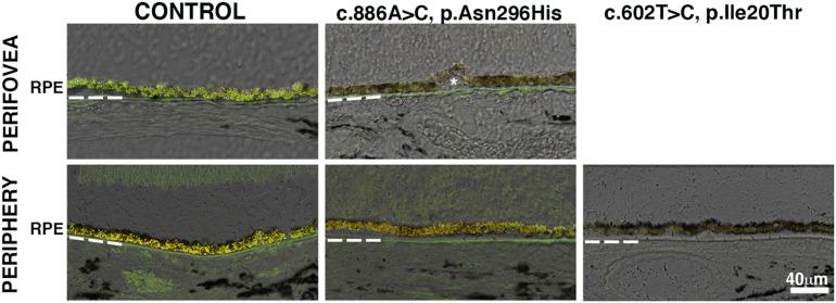 https://cdn.ncbi.nlm.nih.gov/pmc/blobs/6907/7591587/132e382819a9/fcell-08-573330-g002.jpg