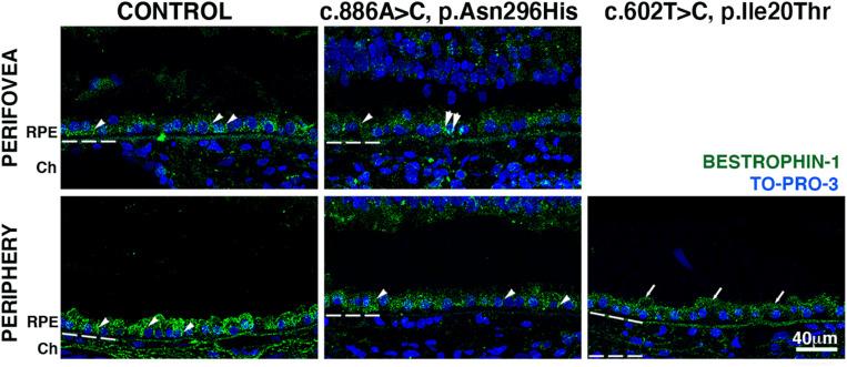 https://cdn.ncbi.nlm.nih.gov/pmc/blobs/6907/7591587/13648fae10ff/fcell-08-573330-g005.jpg