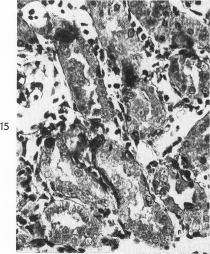 https://cdn.ncbi.nlm.nih.gov/pmc/blobs/690d/1942210/4ac0be9ffc38/amjpathol00352-0120-c.jpg