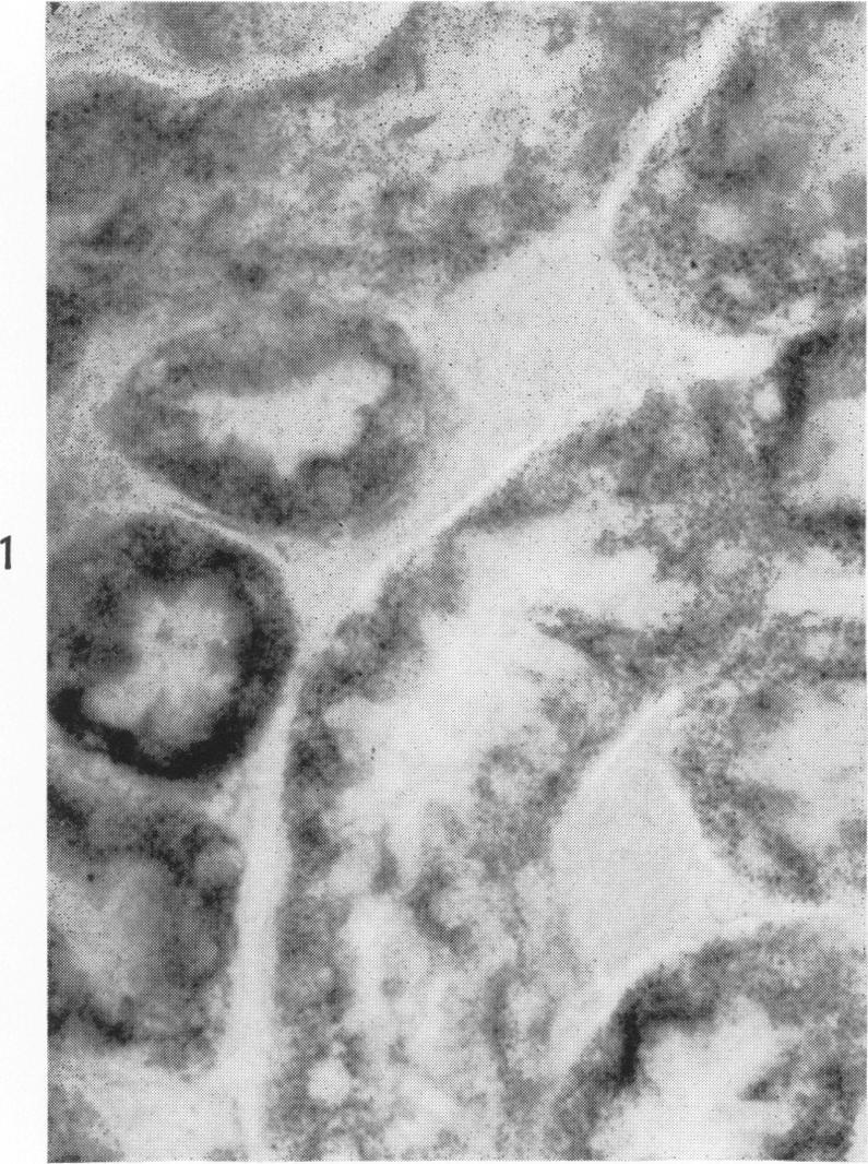https://cdn.ncbi.nlm.nih.gov/pmc/blobs/690d/1942210/b5f6d0c8f342/amjpathol00352-0114-a.jpg
