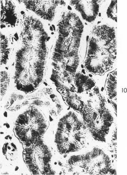 https://cdn.ncbi.nlm.nih.gov/pmc/blobs/690d/1942210/c9410a1ef249/amjpathol00352-0118-b.jpg