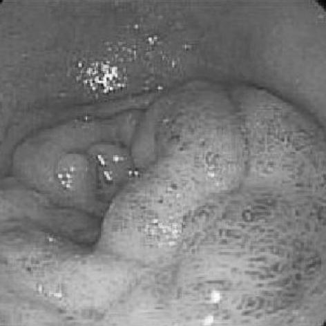 https://cdn.ncbi.nlm.nih.gov/pmc/blobs/690e/2526515/14f284b3f1f6/jkms-23-540-g001.jpg