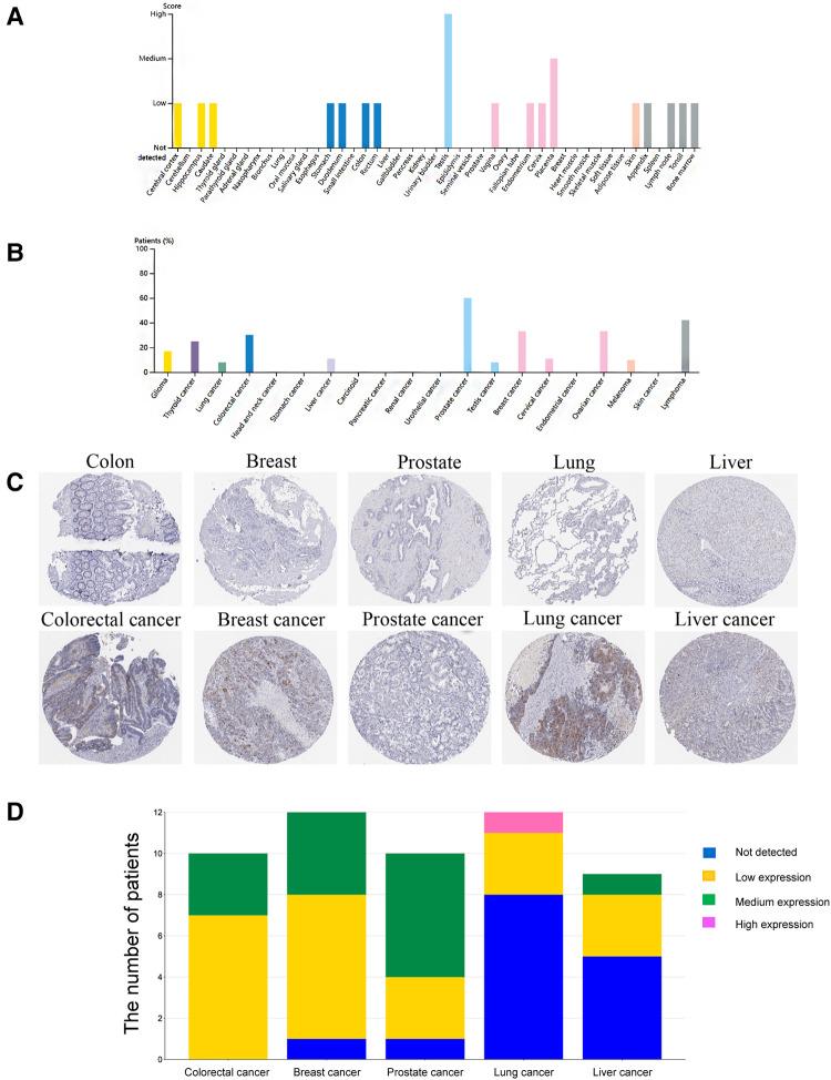 https://cdn.ncbi.nlm.nih.gov/pmc/blobs/690f/9873350/66b642b12871/fsurg-09-998598-g010.jpg