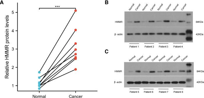 https://cdn.ncbi.nlm.nih.gov/pmc/blobs/690f/9873350/fc2af7b1378c/fsurg-09-998598-g011.jpg