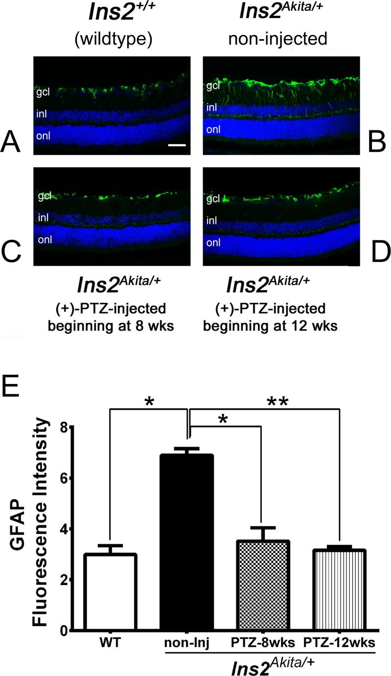 https://cdn.ncbi.nlm.nih.gov/pmc/blobs/691f/4884059/6cd481ad40ba/i1552-5783-57-6-2770-f03.jpg