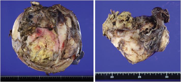 https://cdn.ncbi.nlm.nih.gov/pmc/blobs/6920/12377975/77d09ff26117/scr-11-01-25-0150-g004.jpg