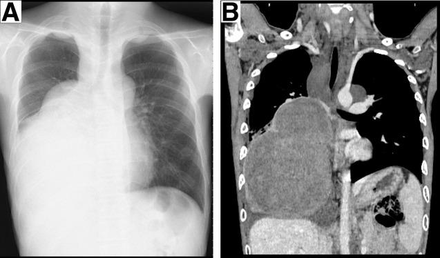 https://cdn.ncbi.nlm.nih.gov/pmc/blobs/6920/12377975/a013e2de305a/scr-11-01-25-0150-g001.jpg