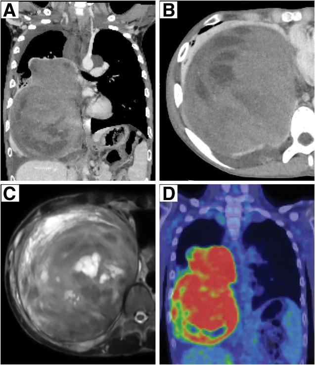 https://cdn.ncbi.nlm.nih.gov/pmc/blobs/6920/12377975/bba107db2dc3/scr-11-01-25-0150-g002.jpg