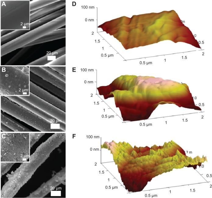 https://cdn.ncbi.nlm.nih.gov/pmc/blobs/6921/4189703/69b34df00048/ijn-9-4569Fig1.jpg