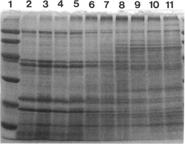 https://cdn.ncbi.nlm.nih.gov/pmc/blobs/6922/205048/a2f637663022/jbacter00020-0029-a.jpg