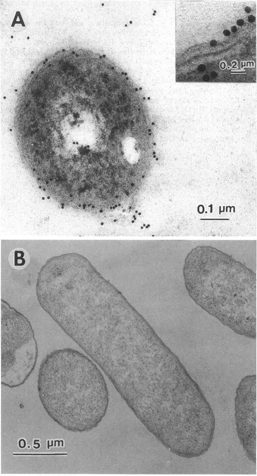 https://cdn.ncbi.nlm.nih.gov/pmc/blobs/6922/205048/fe326f7af5d2/jbacter00020-0033-a.jpg