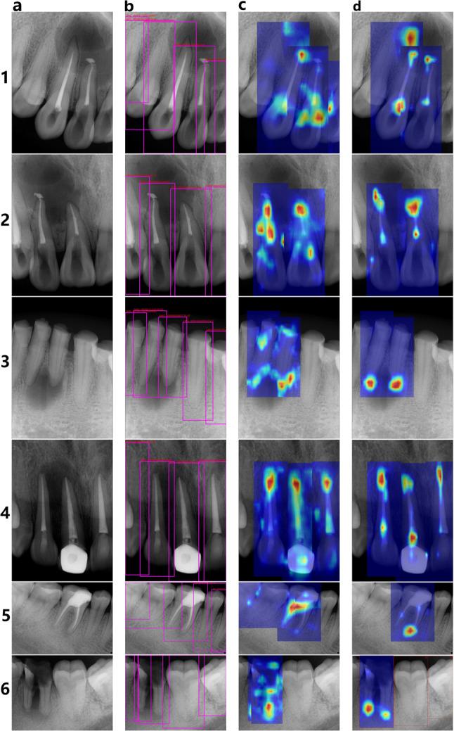 https://cdn.ncbi.nlm.nih.gov/pmc/blobs/692b/11511854/bac4b6e18e6d/41598_2024_75748_Fig8_HTML.jpg