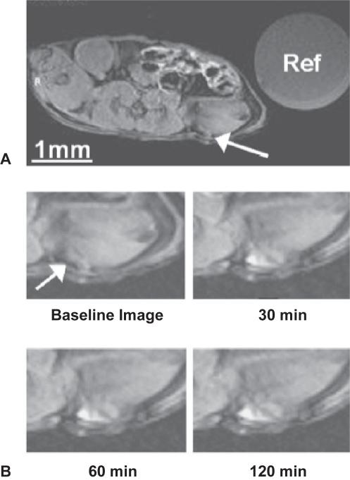 https://cdn.ncbi.nlm.nih.gov/pmc/blobs/6935/2676820/0f54dc83f45a/ijn-2-515f7.jpg