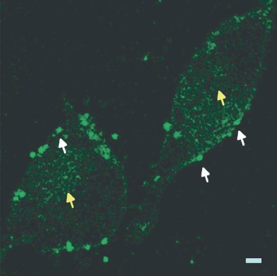https://cdn.ncbi.nlm.nih.gov/pmc/blobs/6935/2676820/9f0299613a7d/ijn-2-515f10.jpg
