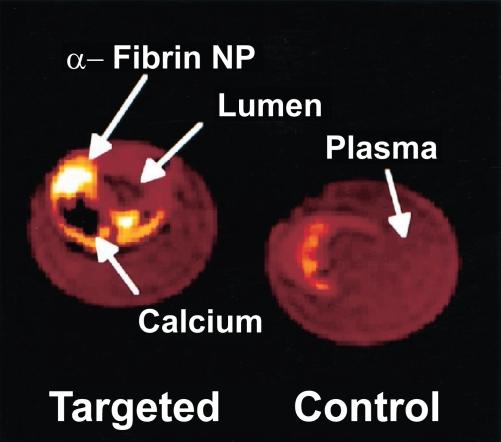 https://cdn.ncbi.nlm.nih.gov/pmc/blobs/6935/2676820/c7820aac528e/ijn-2-515f4.jpg