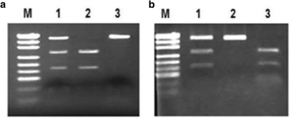 https://cdn.ncbi.nlm.nih.gov/pmc/blobs/694d/4514451/6230ade1f1e0/13046_2015_185_Fig3_HTML.jpg