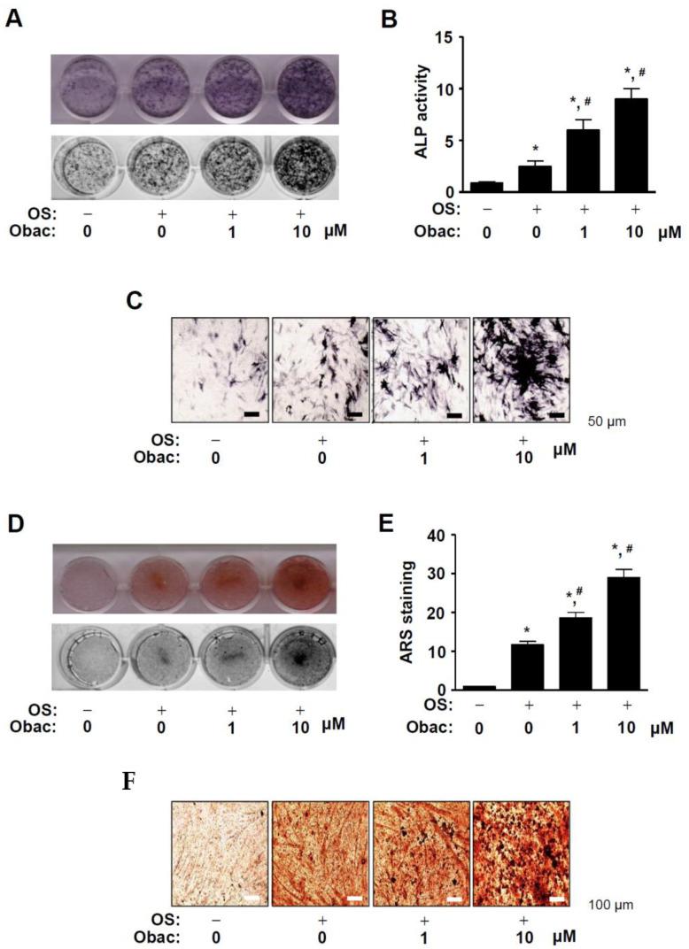 https://cdn.ncbi.nlm.nih.gov/pmc/blobs/694d/7957678/117b3eab6216/ijms-22-02483-g003.jpg