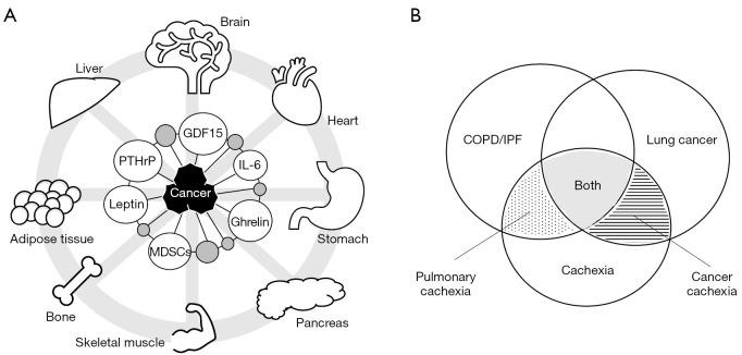 https://cdn.ncbi.nlm.nih.gov/pmc/blobs/694e/9903087/b1e8722d51a3/tlcr-12-01-168-f2.jpg