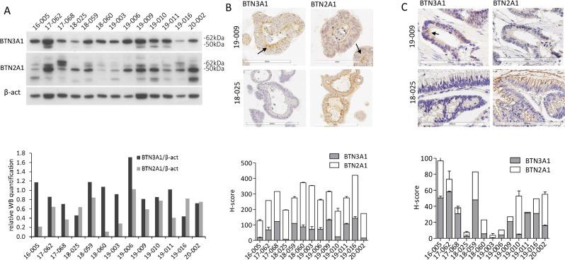 https://cdn.ncbi.nlm.nih.gov/pmc/blobs/6953/9772689/fc556d2dfa8a/jitc-2022-005660f02.jpg