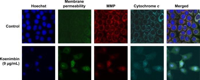 https://cdn.ncbi.nlm.nih.gov/pmc/blobs/6957/4346015/ed03397bcfe8/dddt-9-1193Fig5.jpg