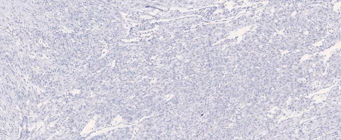 https://cdn.ncbi.nlm.nih.gov/pmc/blobs/6961/10826412/7a083cf2839a/mmcfigs3.jpg