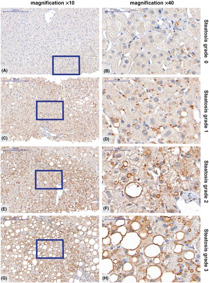 https://cdn.ncbi.nlm.nih.gov/pmc/blobs/6965/9512469/e81886b653c6/HEP4-6-2689-g001.jpg