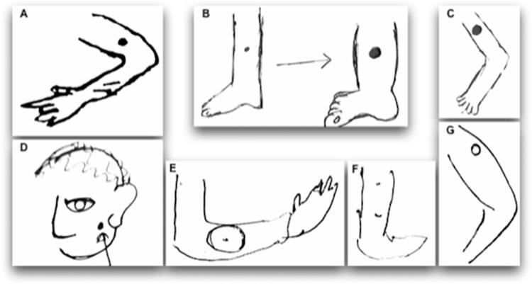 https://cdn.ncbi.nlm.nih.gov/pmc/blobs/6968/10208456/5a5caac29448/pntd.0010939.g002.jpg