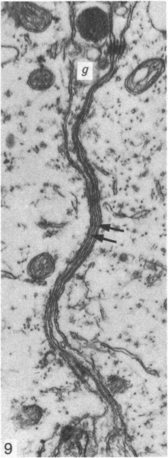 https://cdn.ncbi.nlm.nih.gov/pmc/blobs/696c/1165115/5bed5eac7fe0/janat00195-0138-e.jpg
