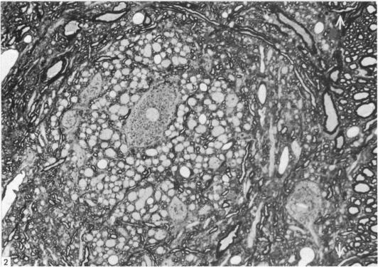 https://cdn.ncbi.nlm.nih.gov/pmc/blobs/696c/1165115/c58d72cad836/janat00195-0137-a.jpg