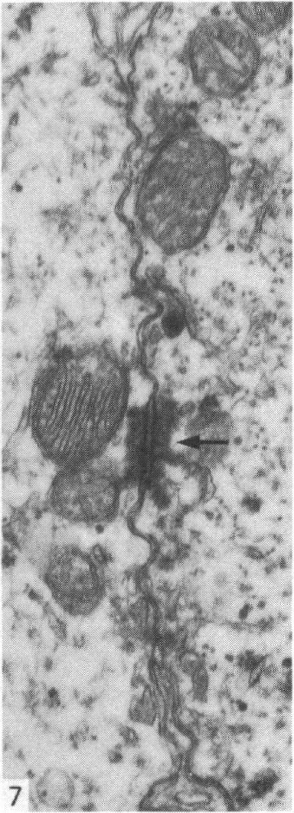 https://cdn.ncbi.nlm.nih.gov/pmc/blobs/696c/1165115/e7c9e1f452e8/janat00195-0138-c.jpg