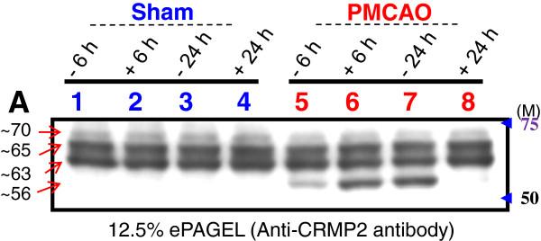 https://cdn.ncbi.nlm.nih.gov/pmc/blobs/6970/3526409/f8f2061af562/1742-2094-9-256-6.jpg