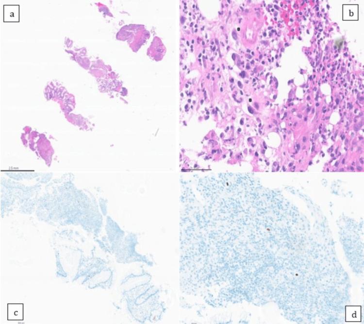 https://cdn.ncbi.nlm.nih.gov/pmc/blobs/6971/12125949/a904d387e951/cureus-0017-00000083290-i02.jpg