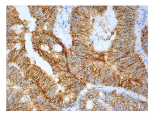 https://cdn.ncbi.nlm.nih.gov/pmc/blobs/6971/2931401/fbee533c10a7/GRP2010-616023.001.jpg