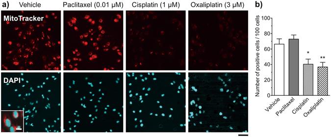 https://cdn.ncbi.nlm.nih.gov/pmc/blobs/6975/5519765/b64ad09cc616/41598_2017_5784_Fig5_HTML.jpg