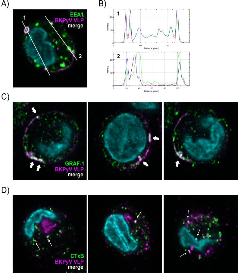 https://cdn.ncbi.nlm.nih.gov/pmc/blobs/697b/7886149/60b086885821/ppat.1009042.g004.jpg