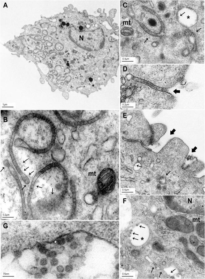 https://cdn.ncbi.nlm.nih.gov/pmc/blobs/697b/7886149/e8382f411275/ppat.1009042.g003.jpg