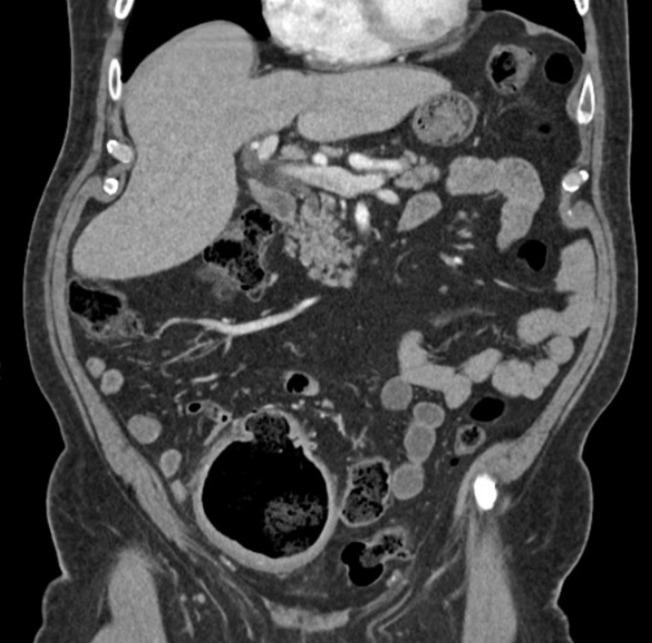https://cdn.ncbi.nlm.nih.gov/pmc/blobs/6982/11185394/7589c11e2efe/WJCC-12-3151-g001.jpg