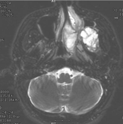 https://cdn.ncbi.nlm.nih.gov/pmc/blobs/6983/1665243/8888283bc1e4/ci05016708.jpg