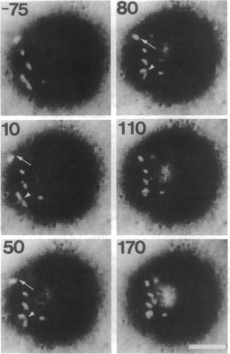 https://cdn.ncbi.nlm.nih.gov/pmc/blobs/6984/43694/d2339fc0aaa5/pnas01131-0456-a.jpg