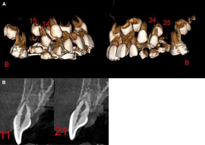 https://cdn.ncbi.nlm.nih.gov/pmc/blobs/698a/10290489/e9c76810c66b/pgad196f2.jpg