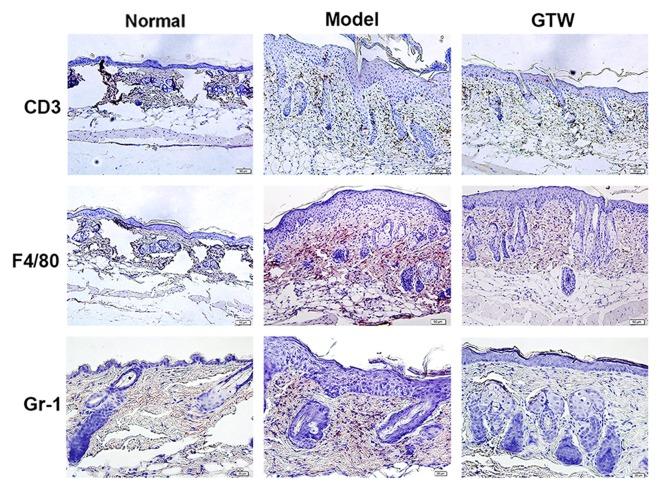 https://cdn.ncbi.nlm.nih.gov/pmc/blobs/698a/4990293/1d79c6926a8d/IJMM-38-03-0747-g02.jpg