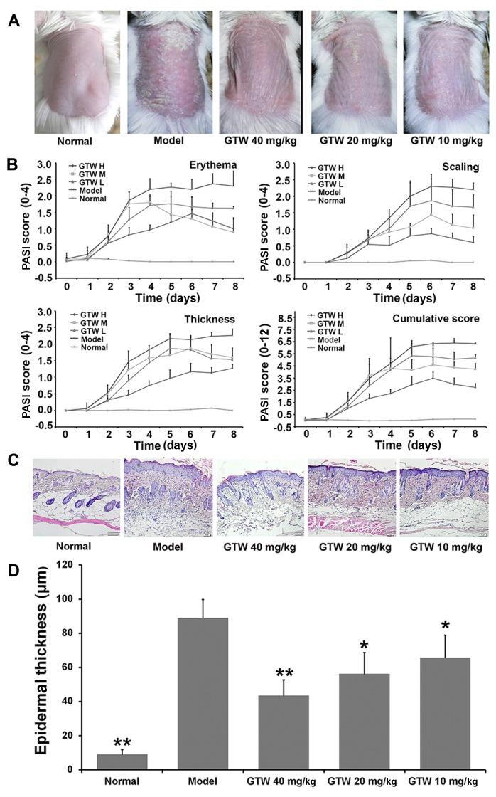 https://cdn.ncbi.nlm.nih.gov/pmc/blobs/698a/4990293/bef4455fed87/IJMM-38-03-0747-g00.jpg
