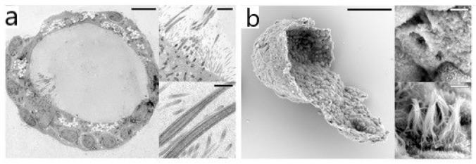 https://cdn.ncbi.nlm.nih.gov/pmc/blobs/698c/8945799/2af923f7b55f/bioengineering-09-00121-g001.jpg