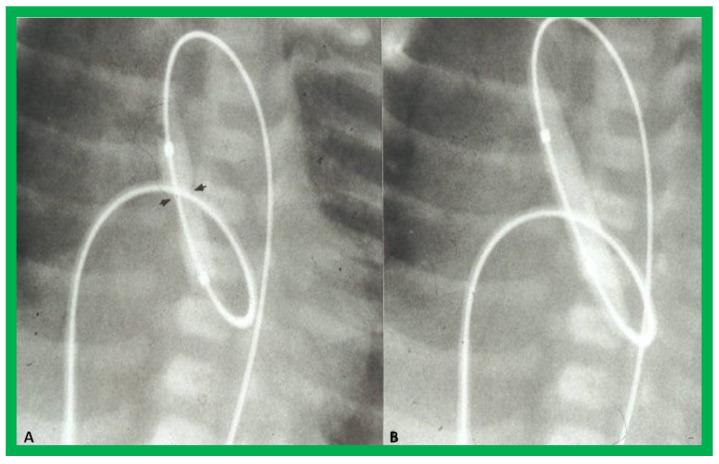 https://cdn.ncbi.nlm.nih.gov/pmc/blobs/6990/10380511/1c833aa2eb1d/jcdd-10-00288-g027.jpg