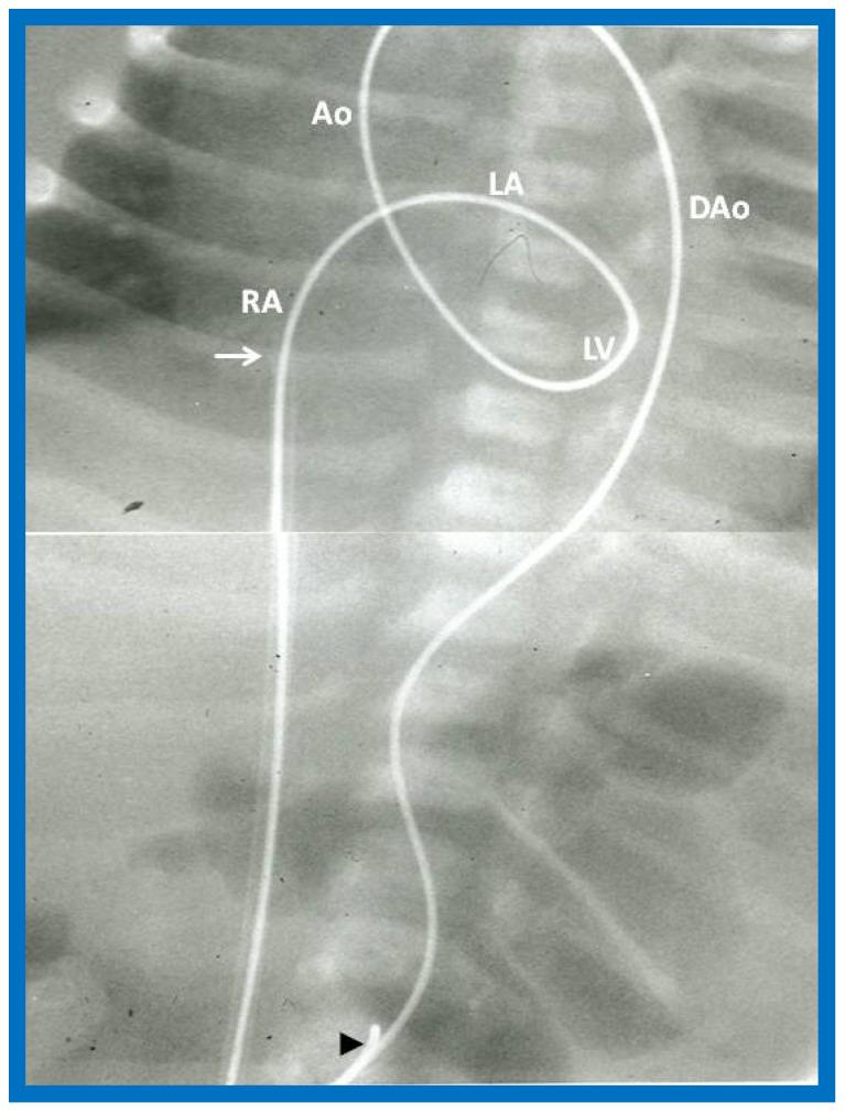 https://cdn.ncbi.nlm.nih.gov/pmc/blobs/6990/10380511/2a941ccbddaa/jcdd-10-00288-g029.jpg