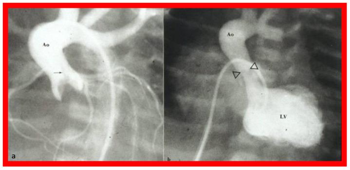 https://cdn.ncbi.nlm.nih.gov/pmc/blobs/6990/10380511/2c13fe31d193/jcdd-10-00288-g026.jpg