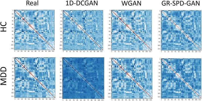 https://cdn.ncbi.nlm.nih.gov/pmc/blobs/6991/12358810/dc977de5ac5c/HBM-46-e70322-g001.jpg