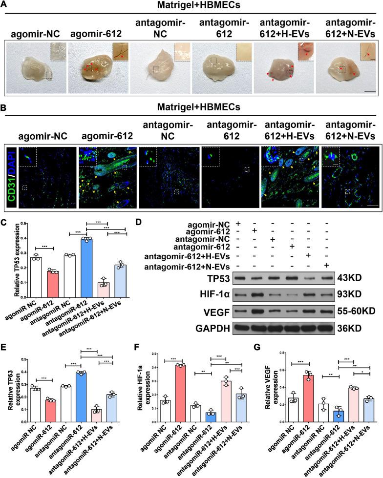 https://cdn.ncbi.nlm.nih.gov/pmc/blobs/6993/8607643/1325661942a3/12951_2021_1126_Fig9_HTML.jpg