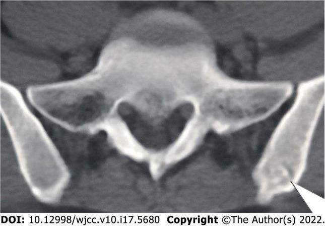 https://cdn.ncbi.nlm.nih.gov/pmc/blobs/6993/9258354/c03e2fd9c9e1/WJCC-10-5680-g003.jpg
